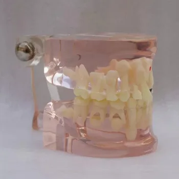 

Dental Oral Clear Mixed Age with Caries Educational Study Model