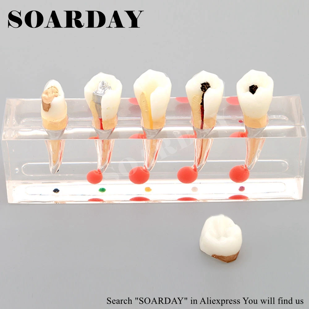 Endodontic Model (1)