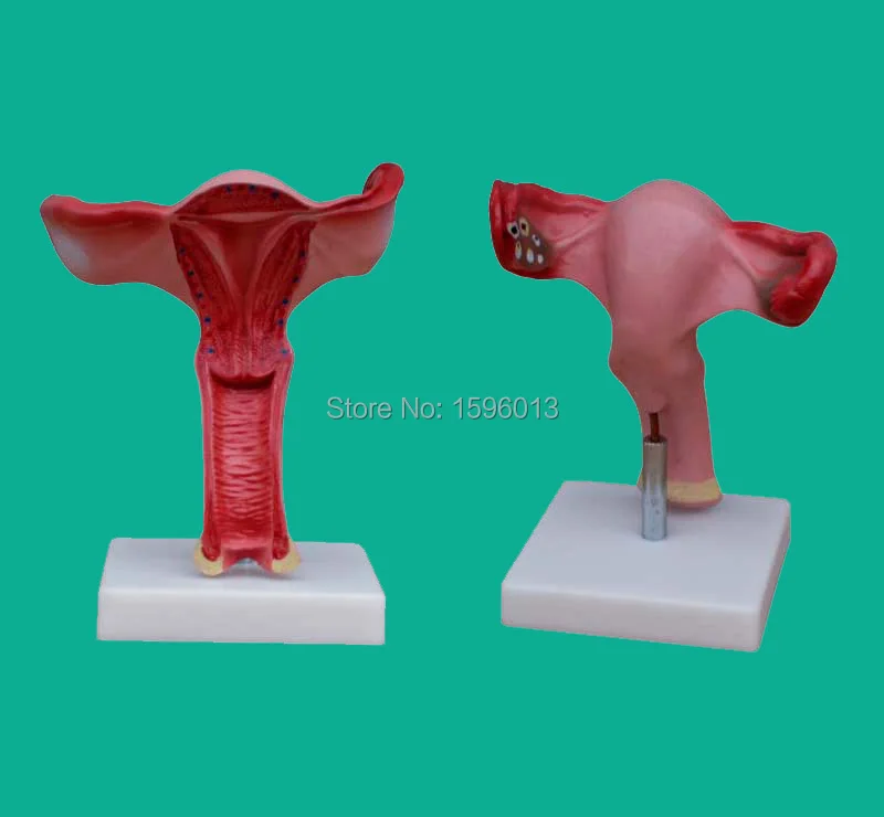 Anatomical Uterus Model, Female Internal Genital Modelin Medical