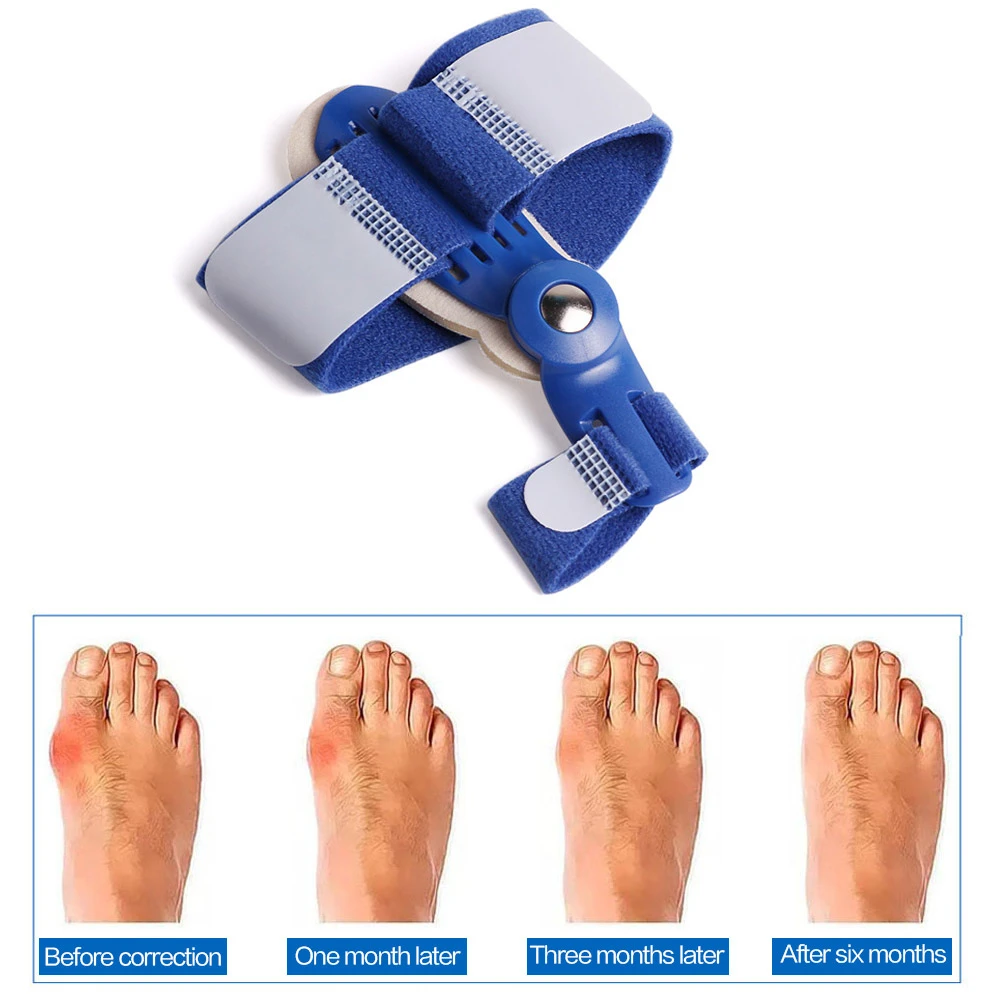 

Big Toe Separator Foot Care Tools Hallux Valgus Corrector Bunion Toe Separators Orthopedic Supplies Finger Protective Sleeve