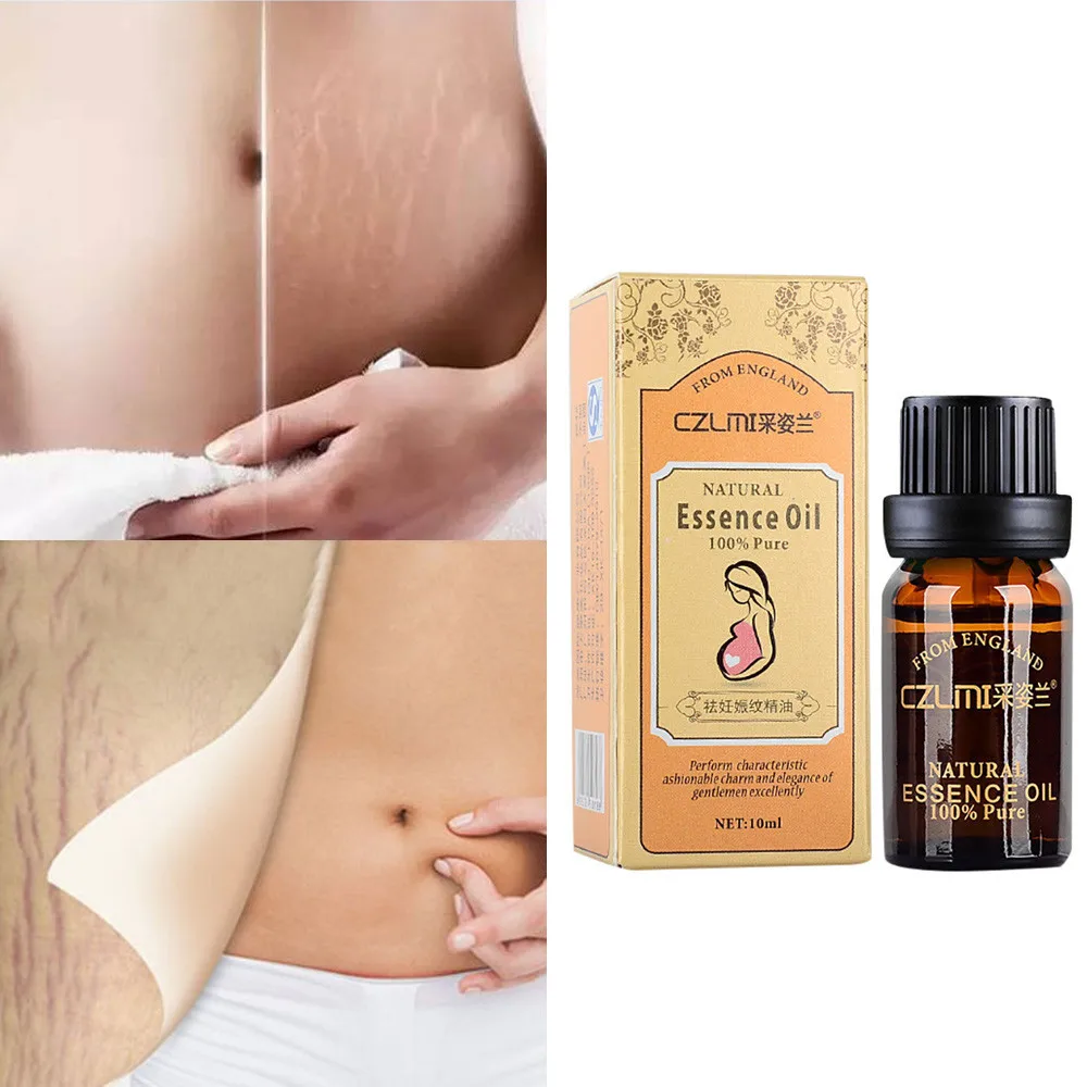 

10ML Natural Essential Oil 100% Pure Stretch Mark Massage Essential Oil Pregnancy Repair Scar Slack Line Abdomen Skin Repairing