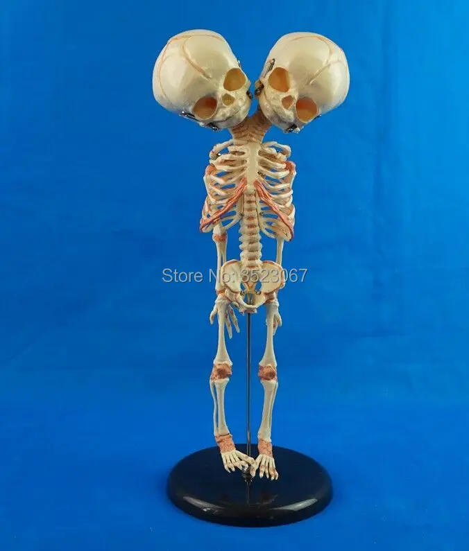 35cm Human New Double Head Baby Anatomy Education Skull Skeleton Study Display 