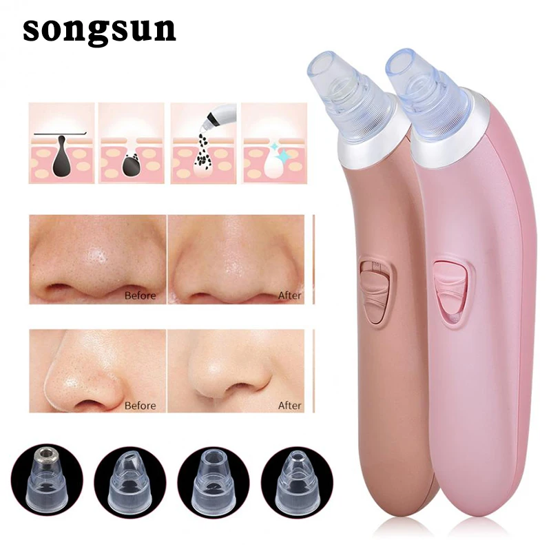 

Handheld Electric Blackhead Remover Cleaner Vacuum Suction Facia Blackhead Removal Skin Care Cleansing Tool Pore Cleaner