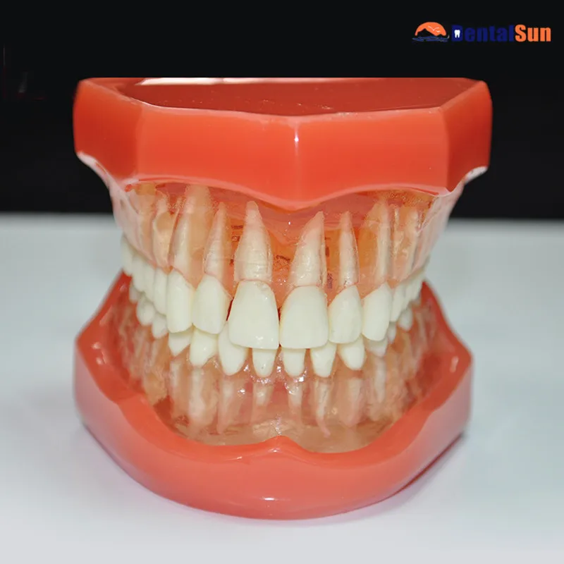 Мягкая десна. Фиксация челюсти детский. Макет зубной челюсти. Мягкая десна. Мягкая десна.