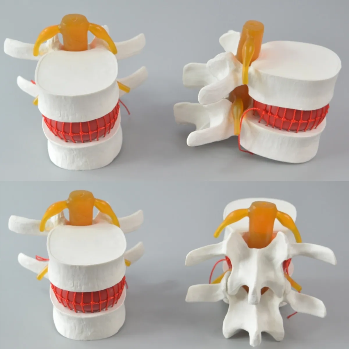 Человеческий анатомический Скелет спина поясница дисковая грыжа обучающая модель мозговой череп травматический пистолет школьные принадлежности медицинский инструмент