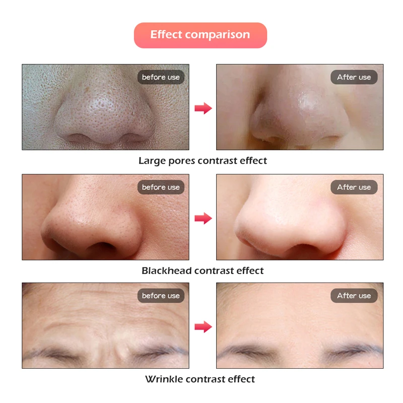  7 Colors LED Facial Mask Beauty Skin Rejuvenation Photon Light Mask with Neck Therapy Wrinkle Acne  - 33020603797