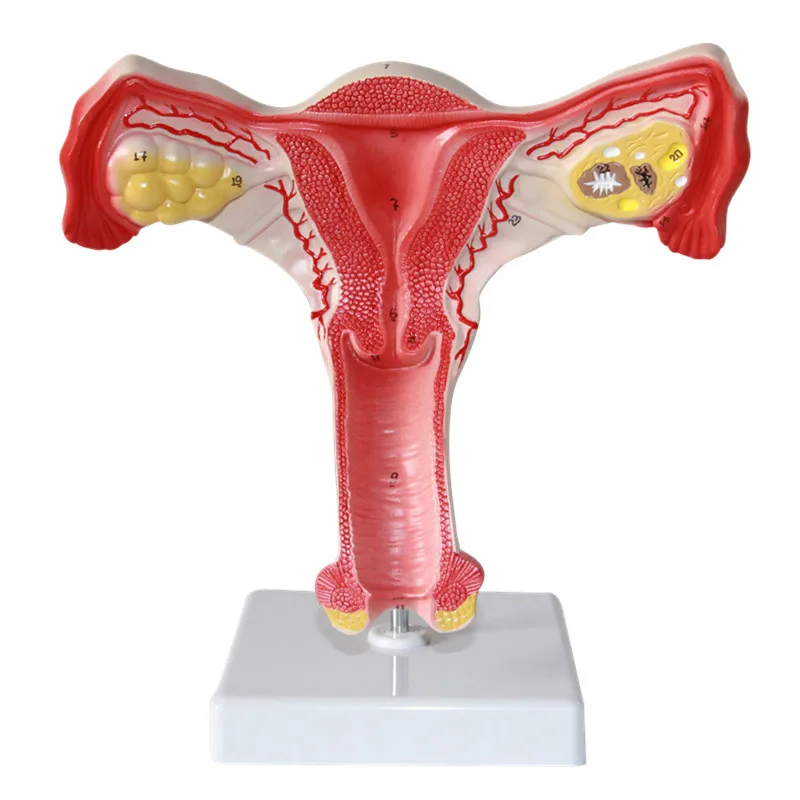 Uterine Model Vagina Ovarian Model Female Internal And External Genital Anatomy Model Anatomy Model Model Anatomyfemale Genital Anatomy Aliexpress
