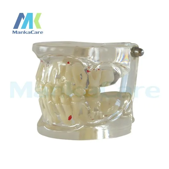 Manka Cuidar-claro Misturado Idade Modelo Dente Dentes Orais 3 China tooth teeth Suppliers