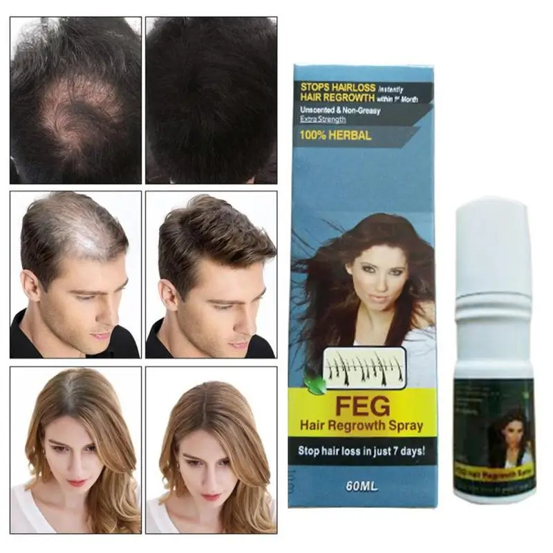 New Original growth hair spray Extra Strength Alopecia Hairs Growth