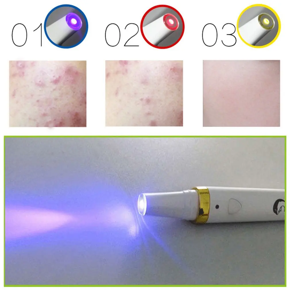 

HOT 3 Colors LED Soft Laser Acne Pen Wrinkle Removal Light Treatment Skin Face Diamond PeelingTool plasma pen