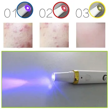 

HOT 3 Colors LED Soft Laser Acne Pen Wrinkle Removal Light Treatment Skin Face Diamond PeelingTool plasma pen
