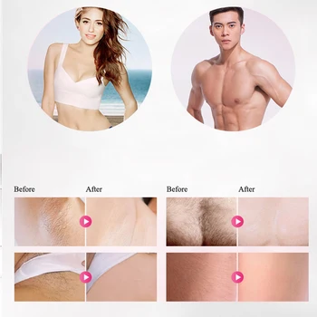 

IPL epilator laser hair removal