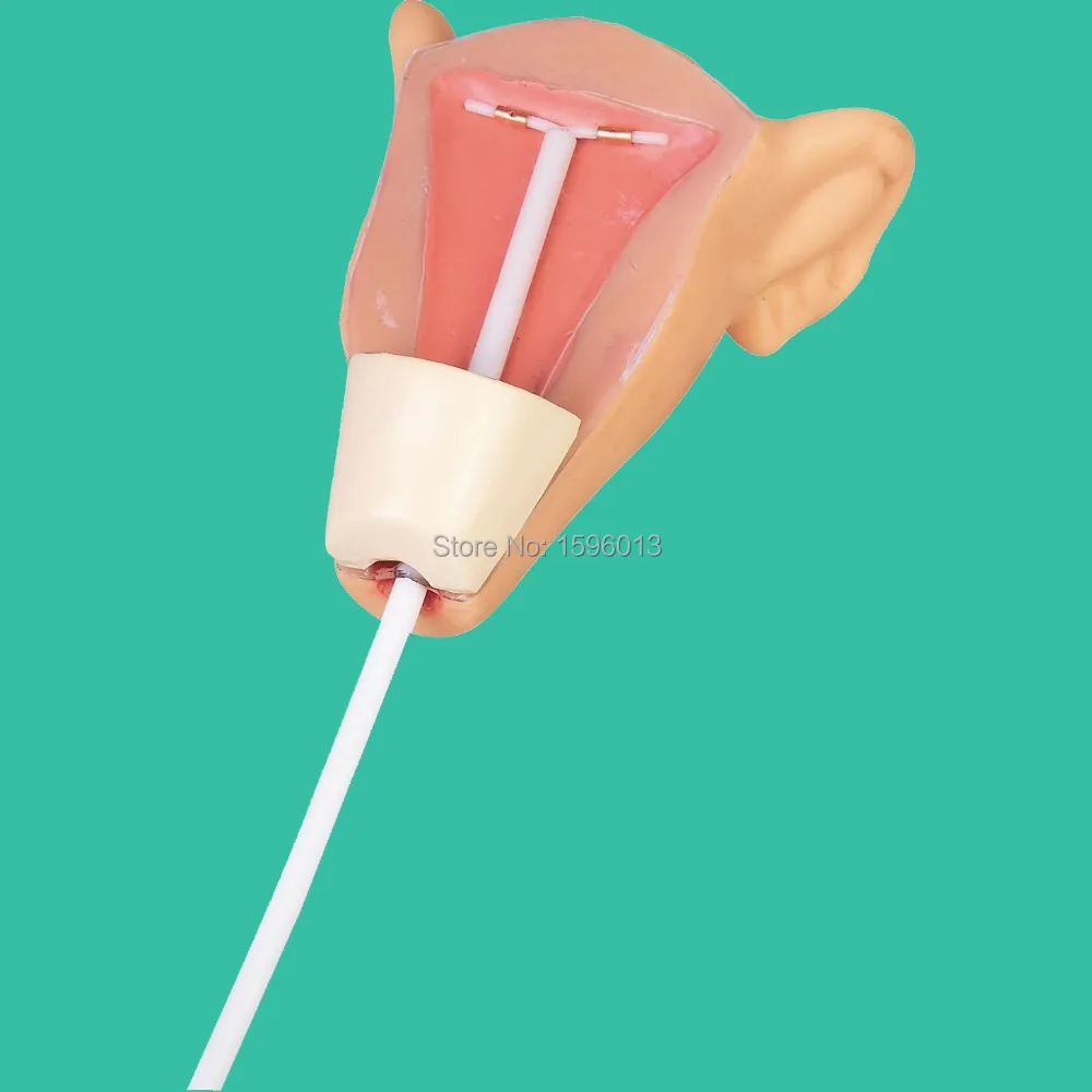 IUD Training Simulator, Intrauterine contraceptive device training