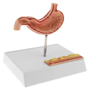 

1: 1 Human Stomach Pathological Model Structure Medical Anatomical Model for School Teaching Tool Learning Display Lab Supplies