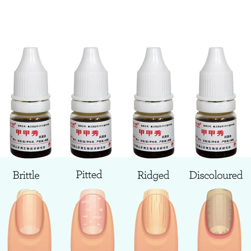 

Lanthome 5ml Anti Infection Nail Fungus Treatment / Onychomycosis Paronychia / Anti Fungal Nail Infection Good Result