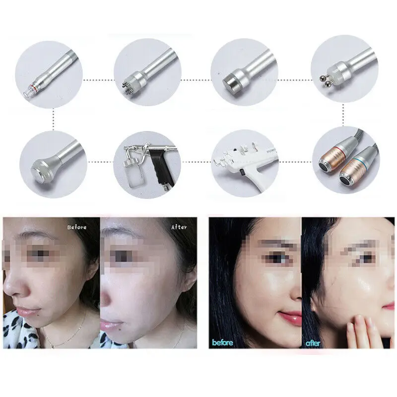 11 in 1 Hydra Dermabrasion RF Bio-lifting Microdermabrasion Facial Machine Water Oxygen Jet Hydro D