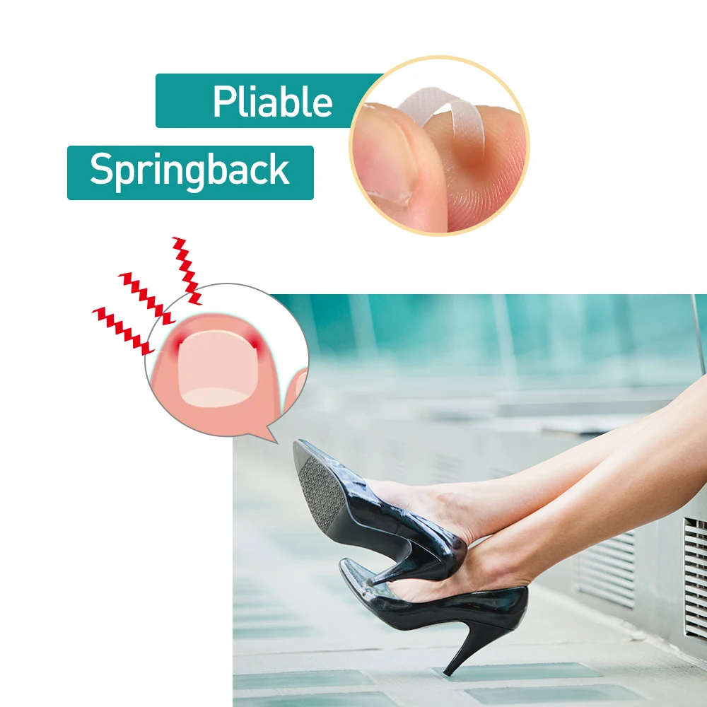 10pcs Toe Nail Ingrown Correction Sticker Patch Foot Care Paronychia Correction File Elastic Patch Corrector Treatment C1510