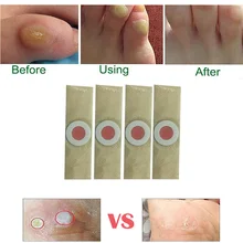 

DUS 50pcs Foot Care Medical Plaster Foot Corn Removal Calluses Plaster Warts Thorn Plaster Health Care For Relieving Pain