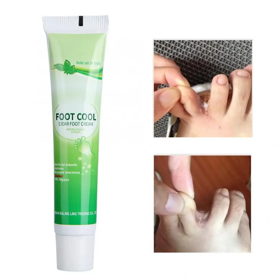 

30g Anti Fungal Relieve Beriberi Foot Cream Skin Care Toe Treatment Anti Fungal Infection Foot Repair