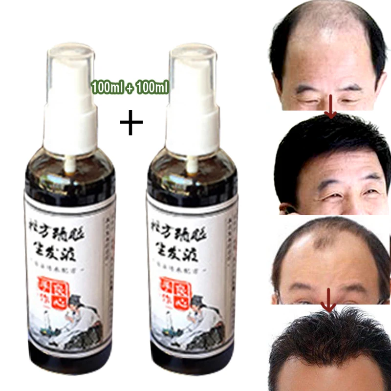 

Hair Loss Products Pure Chinese medicine production growth liquid Raw tincture Essential oil Scalp Treatments Conditioners 2pcs