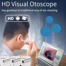 3,9 мм, 4,5 мм, 5,5 мм, HD камера для чистки ушей, эндоскоп, 1,0 мегапикселей, Бороскоп, камера для осмотра, инструмент для ушей, для Android PC