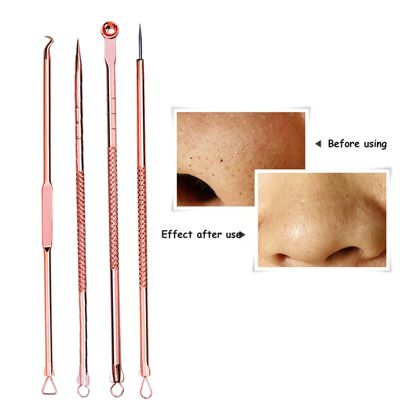 

4Pcs Blackhead Pimple Blemish Comedone Acne Extractor Remover Tool Set Spot Cleaner Blackhead Whitehead Needles Remover Acne