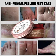 Крем для ног с конским маслом Увлажняющий анти-чаппинг противогрибковый разглаживающий Уход за ногами OR88