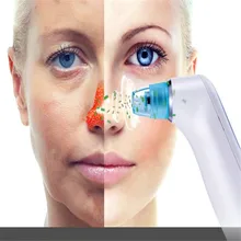 Косметический инструмент вакуумный отсос угрей очищающее устройство для лица глубокое очищение грязи акне угрей бытовой очиститель пор