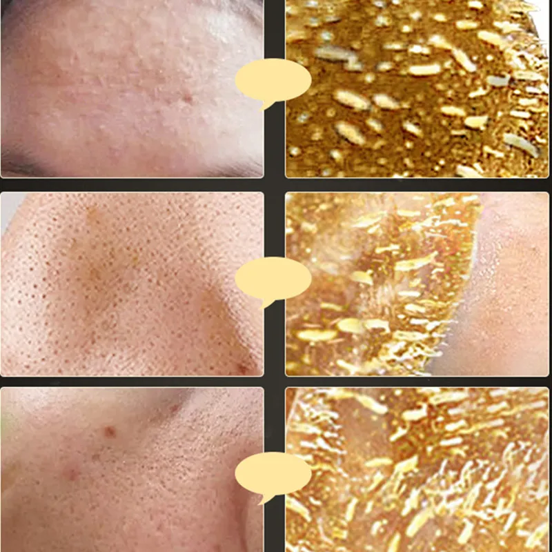 Изображения золото удалить угри маска сужает поры улучшает грубую маска для носа против черных точек Shills маска для удаления угрей увлажняющий лицо крем