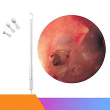 Устные зеркало осмотра ушное зеркало эндоскоп электронный Микроскоп USB ушному каналу осмотр носовой обнаружения дома бороскопов