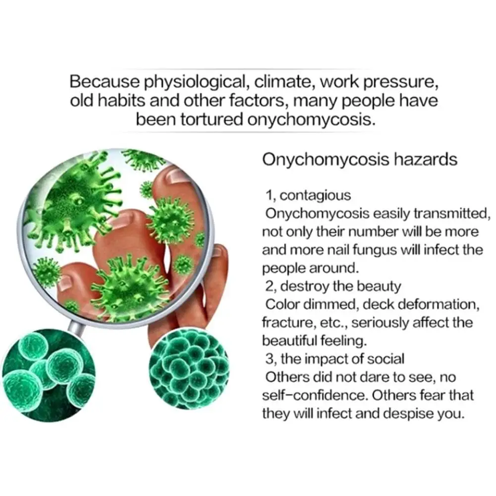 Грибок для ногтей Уход восстановление ногтей и ног уход за руками отбеливание пальцев ног против грибка инфекция жидкость для удаления кутикулы