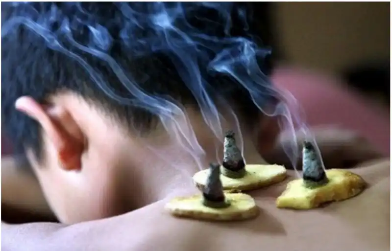 500g 30:1 / 40:1 / 60:1 gold moxa chinese