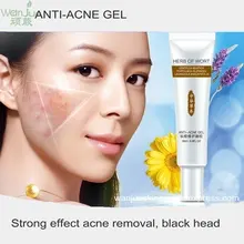 Лечение акне угрей удаление крем против акне масло Управление уменьшение пор, акне шрам удаления уход за лицом; отбеливание травяной чистки