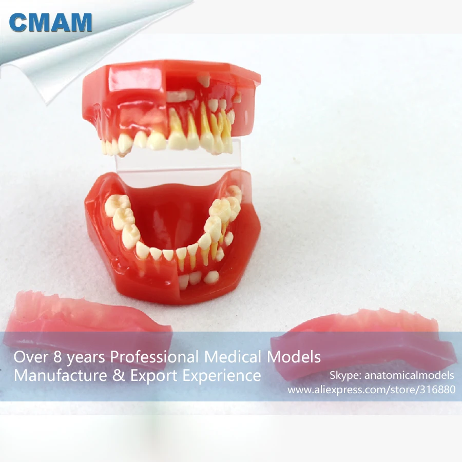 12596 cmam-dental16 развивающие Исследование Модели W/съемный розовый Силиконовый десны, Медицинские товары преподавания анатомические модели