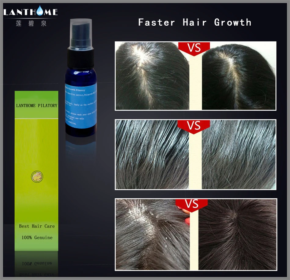 Lanthome Alopecia Areata сыворотка для роста волос предотвращения выпадения лечение