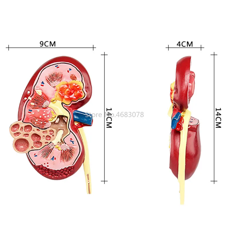Анатомическая модель почек, анатомическая модель, анатомическая модель человека, Обучающие принадлежности