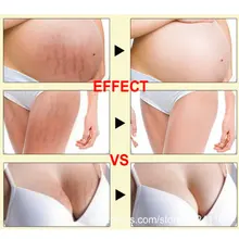 Беременности и родам кожи массажный крем для тела восстановление кожи средство для удаления растяжек мощный от послеродовой полноты крем для беременных уход за кожей