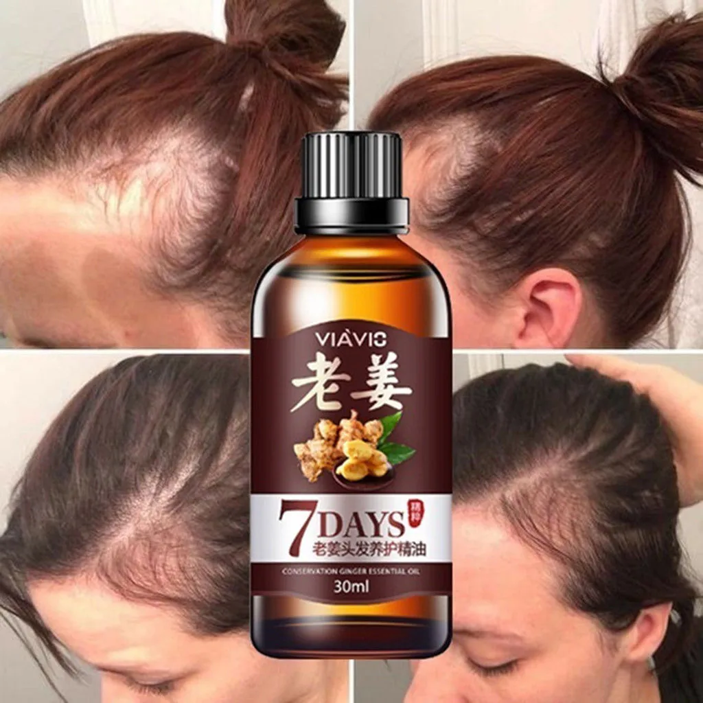 

30ml Hair Growth Serum Essence For Women And Men Anti Preventing Hair Loss Alopecia Liquid Damaged Hair Repair Growing Faster