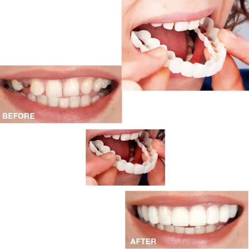 Верхняя ложная Крышка для зубов, мгновенная идеальная улыбка, косметический уход за зубными протезами