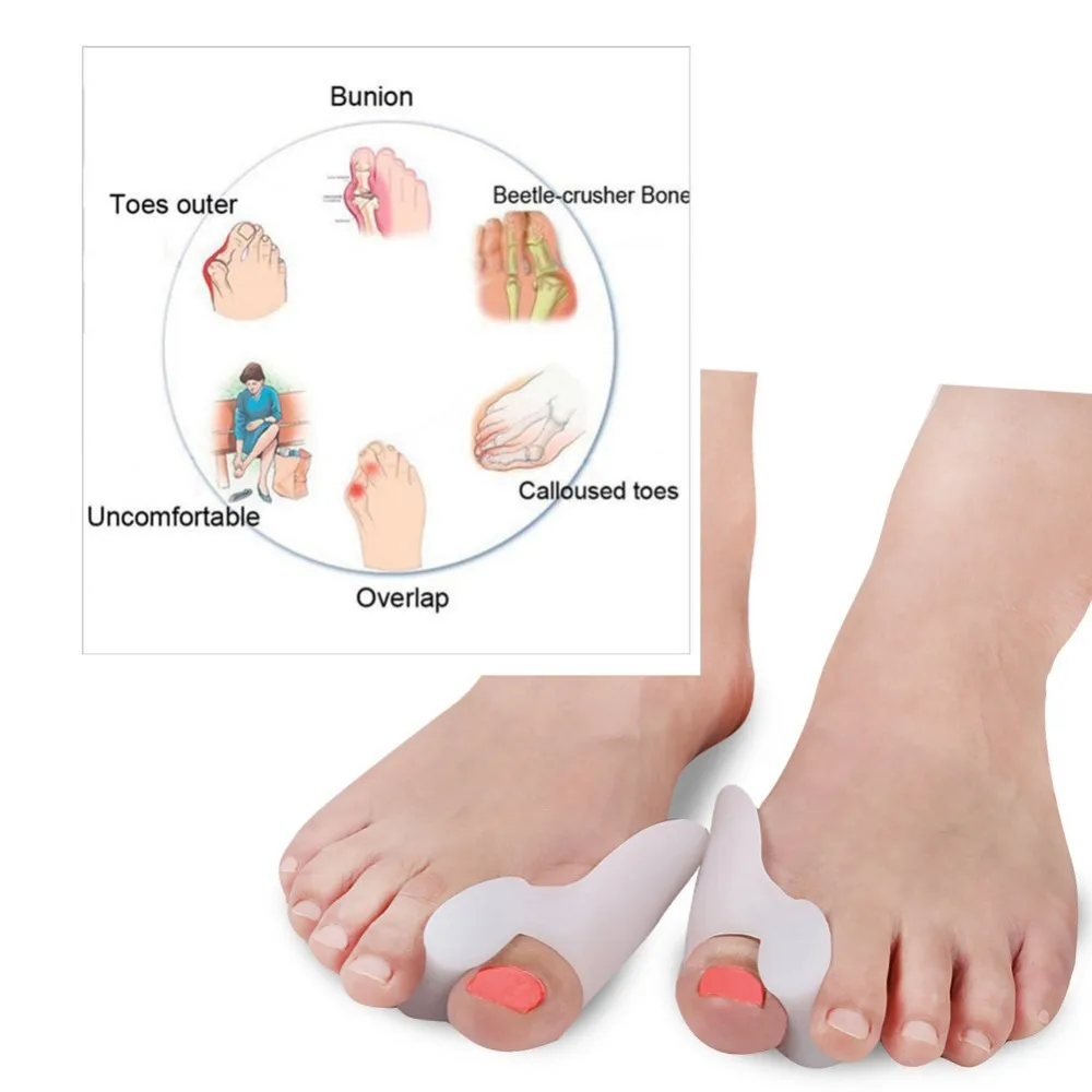 2Pcs-Silicone-Bunion-Toes-Corrector-Orthotics-Straightener-Separator-Ease-Pain