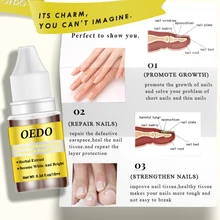 10 мл жидкость для ногтей ремонт бактерицидные одноразовые маски для лица Лечение ногтей Удаление грибка для ногтей увлажняющий уход за ногами TSLM2