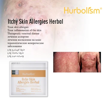 

Natural Herbs Formula for Curing Itchy Skin, Curing Allergies Skin, Improve Skin Texture, 100% Effective, 50g/lot