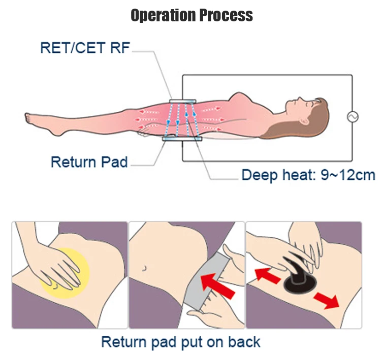 Professional Aesthetics Equipment Rf Cet Ret Slimming Physical Therapy Beauty Machine