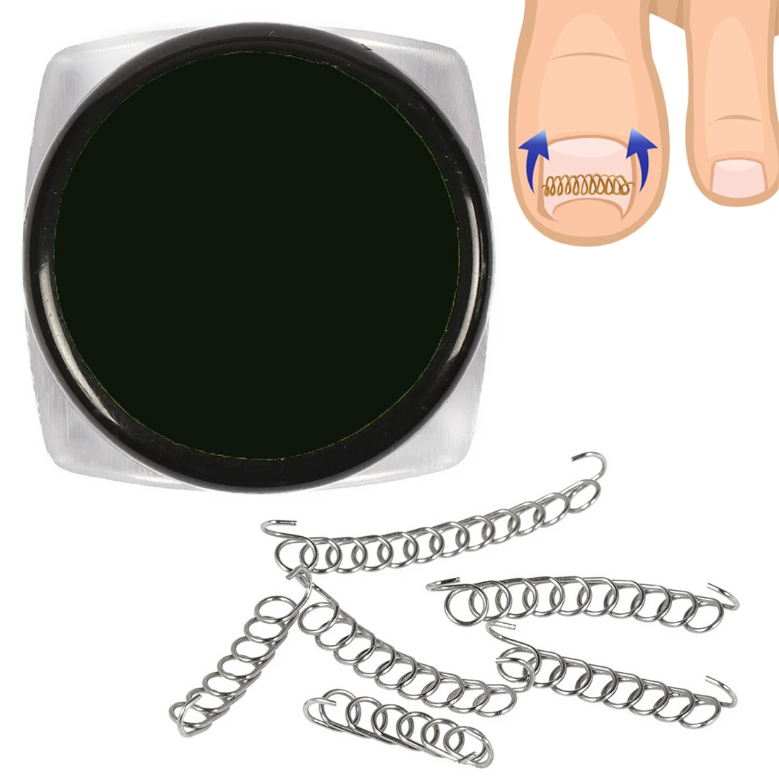 Acronyx Onyxis ortopédicos Pies Pie, herramientas para el cuidado de encarnada del clavo del dedo del pie pedicura corrección de fijador recuperar paroniquia 6 unids/caja Acronyx Onyxis ortopédicos Pies Pie, herramientas para el cuidado de encarnada del clavo del dedo del pie pedicura corrección de fijador recuperar paroniquia 6 unids/caja