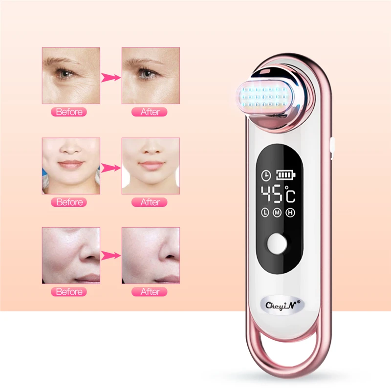 RF Facial Beauty Machine Electric Face Lifting Tighten Remove Wrinkle Massager Skin Rejuvenation Anti-aging Shrink Pores Device RF Facial Beauty Machine Electric Face Lifting Tighten Remove Wrinkle Massager Skin Rejuvenation Anti-aging Shrink Pores Device