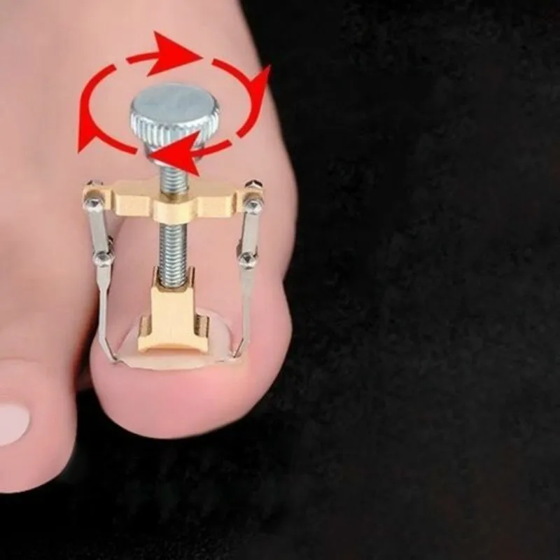 Для вросших ногтей, педикюра Уход за ногтями на ногах инструменты пилка для ног ортопедический акроникс вгребание ногтей Onyxis Bunion корректор для пальцев ног