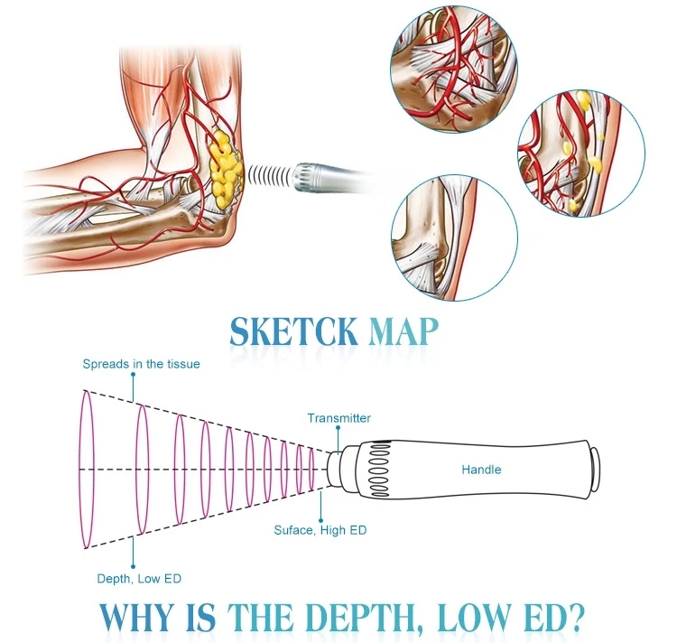 SW5S/ED профессиональная ударная волновая Терапия эффективная физическая болевая терапия экстрапортальная ударная волновая терапия для боли машина