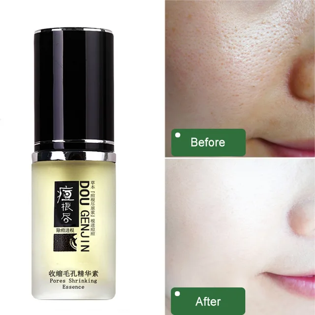 pore cleanser terbaik