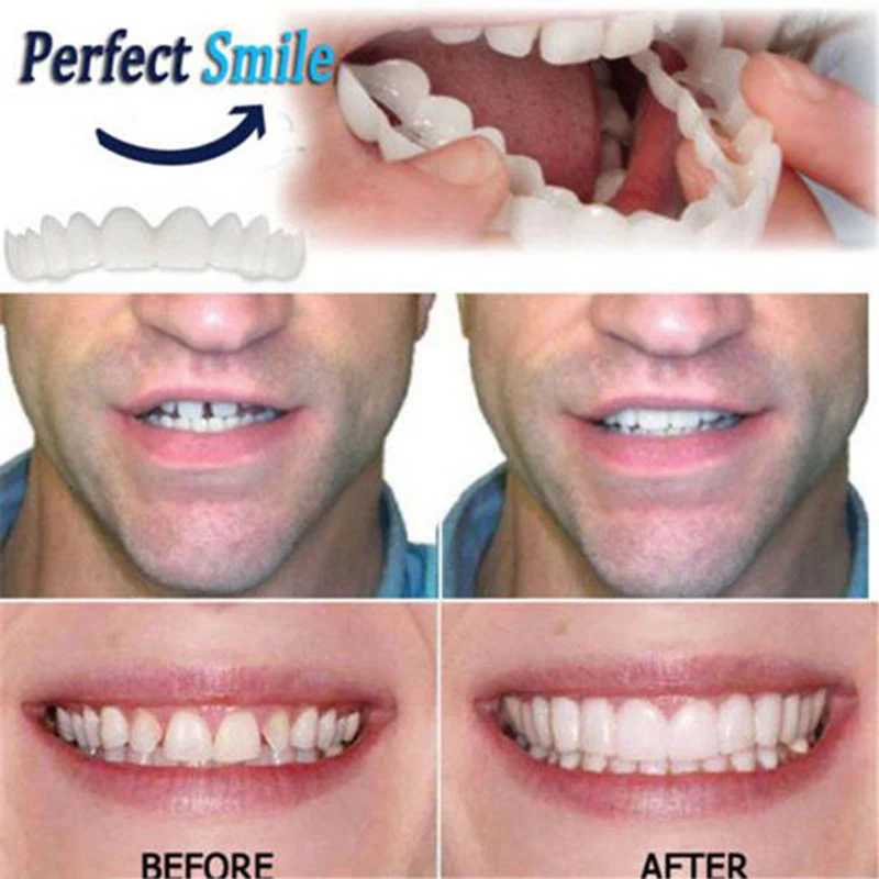 Красивые мгновенные стоматологические виниры улыбка комфорт Fit Flex косметические зубные протезы Зубы Топ косметические виниры