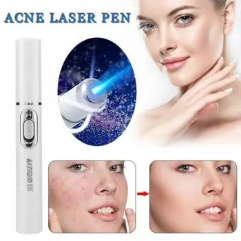 

Medical Blue Light Therapy Laser Treatment Pen Acne Scar Wrinkle Removal Devi